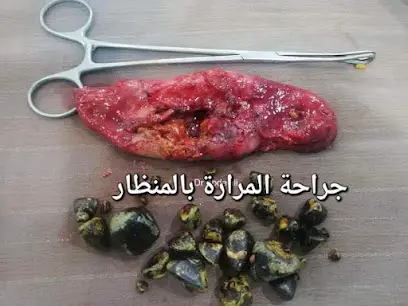 Dr ABDELALI CHIRURGIEN