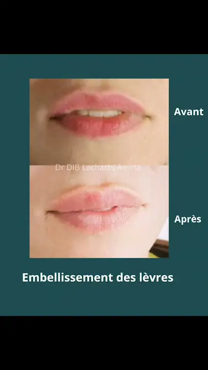 Dr. Amina DIB, dermatologue د. أمينة ديب، طبيبة الأمراض الجلدية