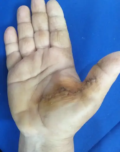 Dr Hadad R. Orthopédiste